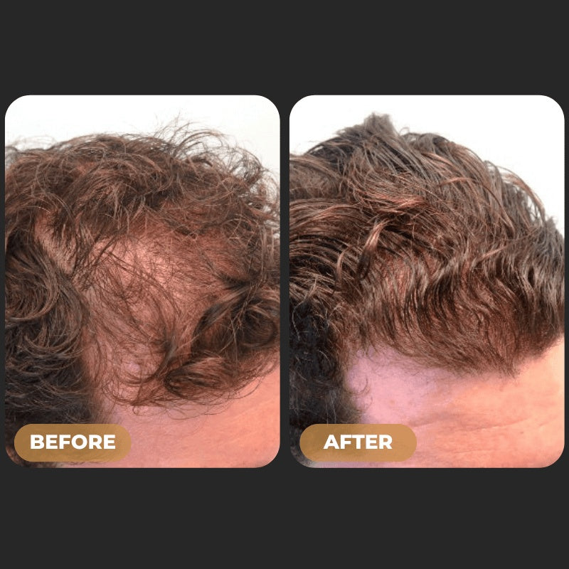 Phydic - Root Activator Spray For Hair
