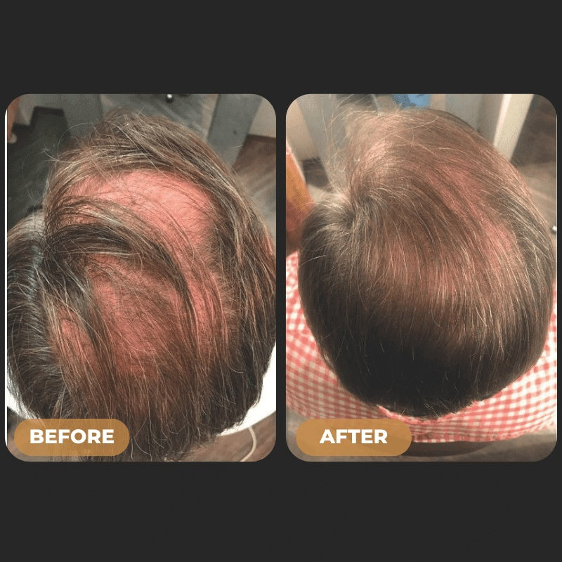 Phydic - Root Activator Spray For Hair