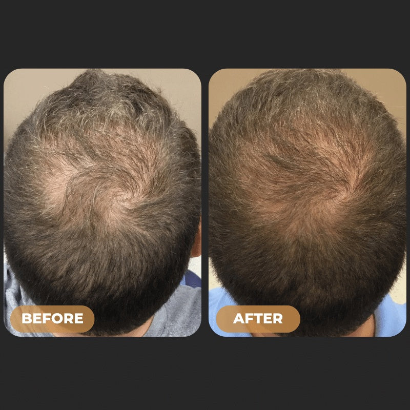Phydic - Root Activator Spray For Hair