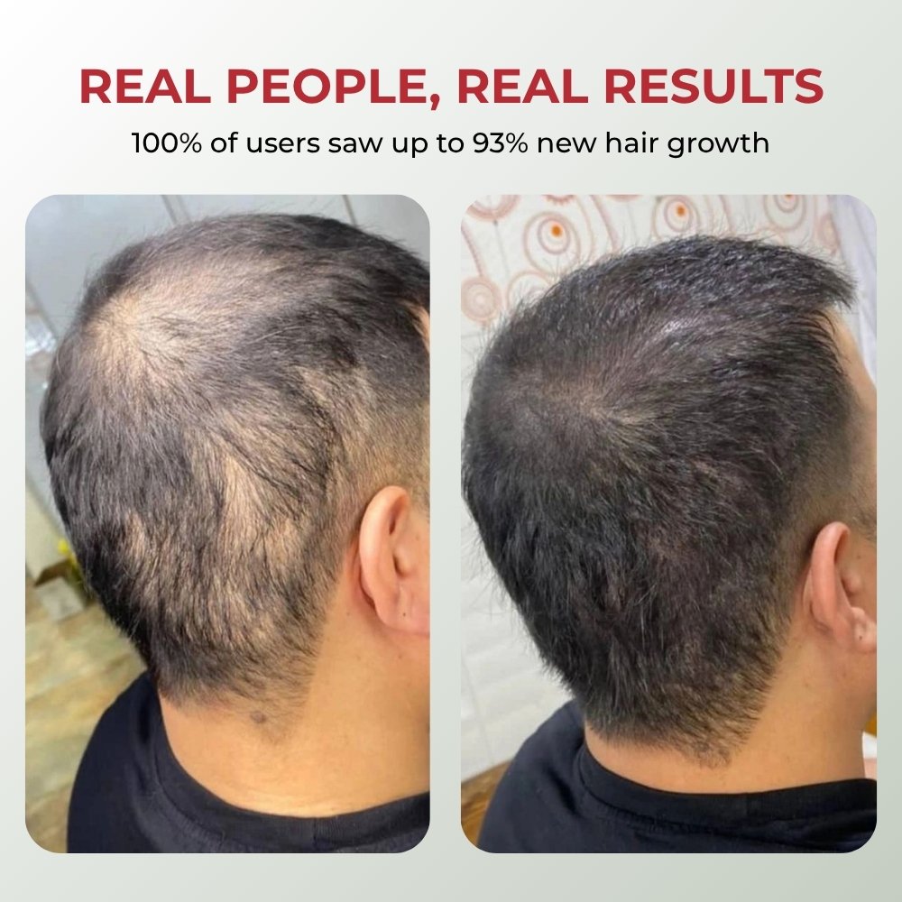 Red Light Growth Cap